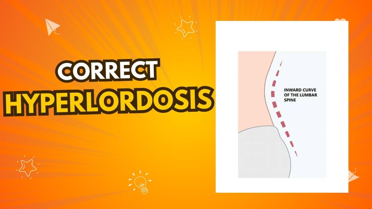 Top Exercises to Correct Hyperlordosis | Improve Posture & Relieve Pain