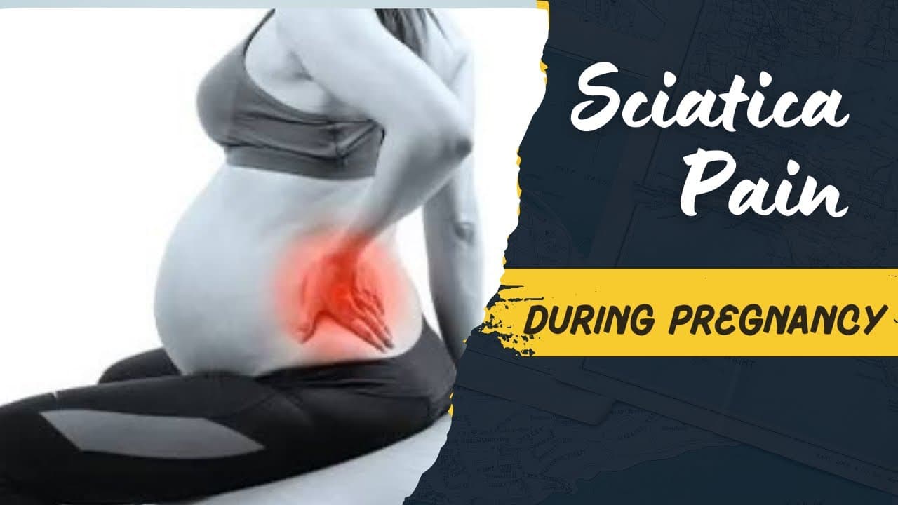 Top 5 Exercises to Ease Sciatica During Pregnancy