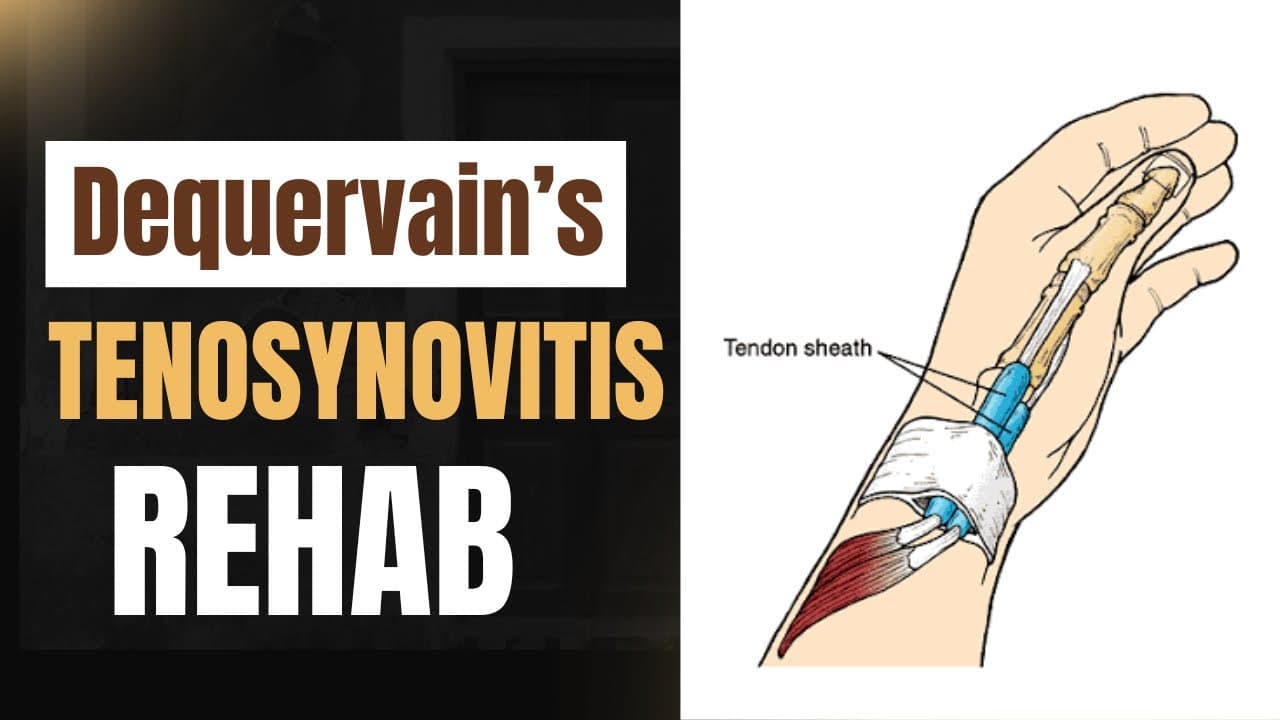 Top Exercises for De Quervain’s Tenosynovitis | Relieve Wrist & Thumb Pain
