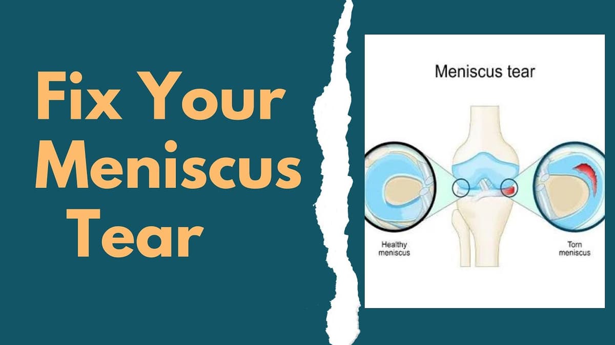 Fix Your Meniscus Tear Without Surgery | Knee Pain Exercises