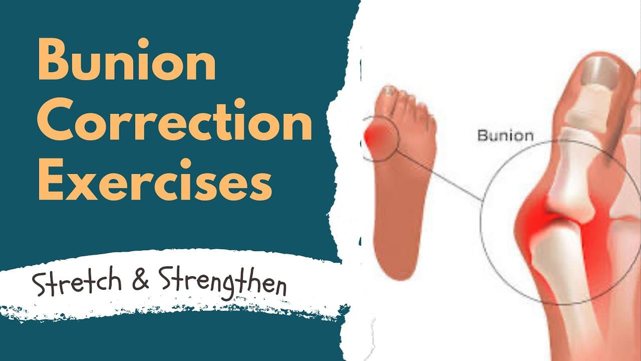 Best Exercises to Relieve Bunion Pain & Improve Toe Alignment Naturally | Foot Strength Tips