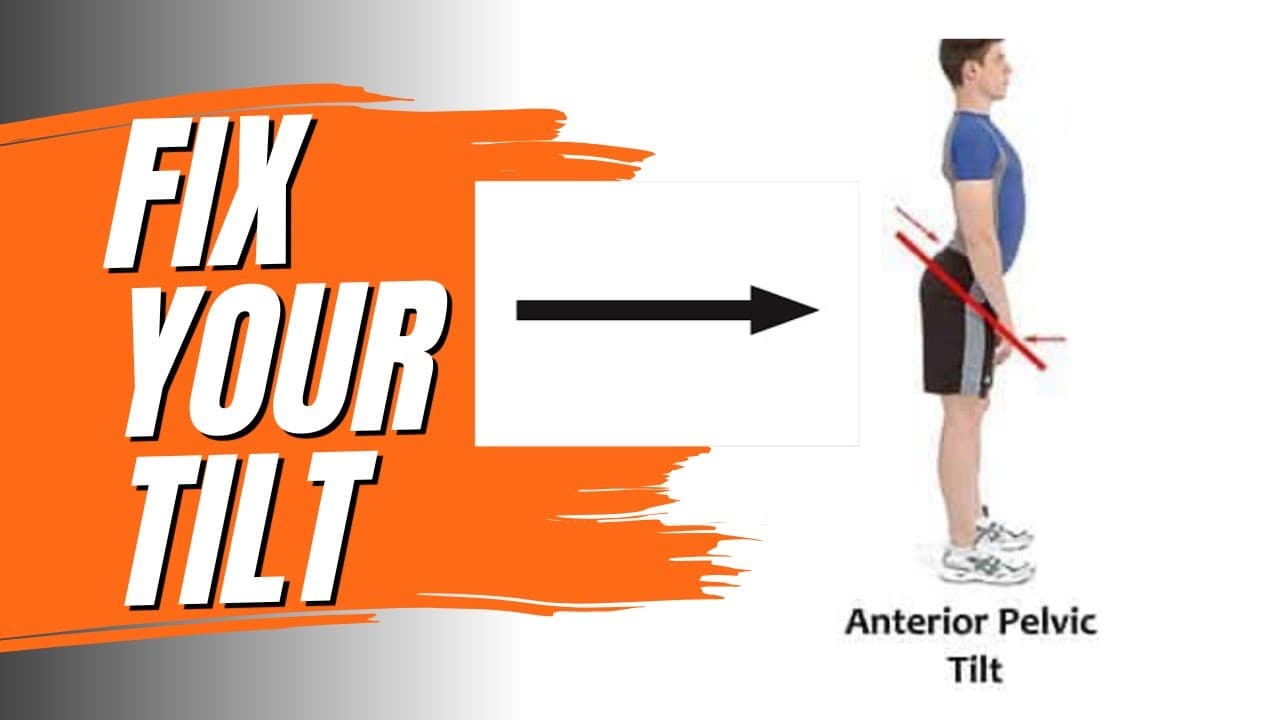 Fix Lower Back Pain from Anterior Pelvic Tilt (Sway Back Posture)