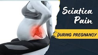 Top 5 Exercises to Ease Sciatica During Pregnancy