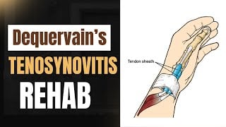 Top Exercises for De Quervain’s Tenosynovitis | Relieve Wrist & Thumb Pain