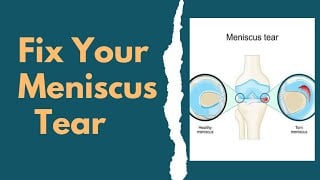 Fix Your Meniscus Tear Without Surgery | Knee Pain Exercises