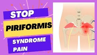Piriformis Syndrome Relief FAST 🔥 Top Stretches & Strengthening Exercises for Sciatica and Hip Pain